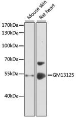 PRAMEF20 Polyclonal Antibody