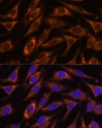 HIBADH Antibody in Immunocytochemistry (ICC/IF)