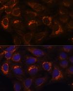 HIBADH Antibody in Immunocytochemistry (ICC/IF)