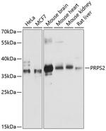 PRPS2 Polyclonal Antibody