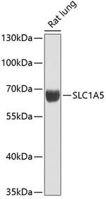 ASCT2 Polyclonal Antibody