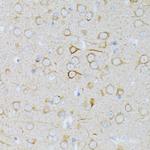 MEK1 Antibody in Immunohistochemistry (Paraffin) (IHC (P))