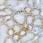 MEK1 Polyclonal Antibody