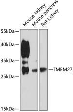 TMEM27 Polyclonal Antibody
