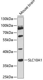 NTCP Polyclonal Antibody