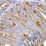 ACE2 Polyclonal Antibody