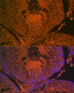 ACE2 Antibody in Immunohistochemistry (Paraffin) (IHC (P))
