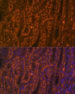 ACE2 Antibody in Immunohistochemistry (Paraffin) (IHC (P))