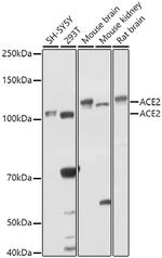 ACE2 Antibody in Western Blot (WB)