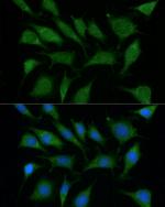 TRIM45 Polyclonal Antibody