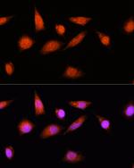COPS8 Antibody in Immunocytochemistry (ICC/IF)