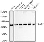 RAB7A Polyclonal Antibody