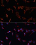 PDIA2 Polyclonal Antibody