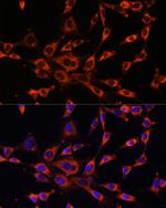ITPR3 Polyclonal Antibody