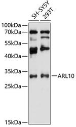 ARL10 Antibody in Western Blot (WB)