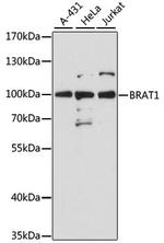 BAAT1 Polyclonal Antibody