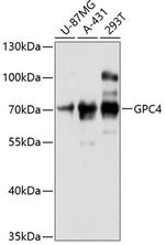 Glypican 4 Polyclonal Antibody