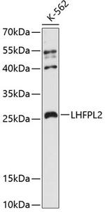 LHFPL2 Antibody in Western Blot (WB)