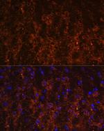 SNX13 Antibody in Immunohistochemistry (Paraffin) (IHC (P))