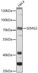 SEMG2 Polyclonal Antibody