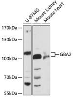 GBA2 Polyclonal Antibody