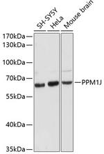 PPM1J Polyclonal Antibody