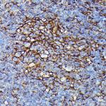 HLA-B Antibody in Immunohistochemistry (Paraffin) (IHC (P))
