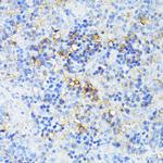 TP53I11 Antibody in Immunohistochemistry (Paraffin) (IHC (P))