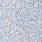 TP53I11 Polyclonal Antibody
