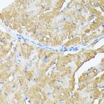 TP53I11 Antibody in Immunohistochemistry (Paraffin) (IHC (P))