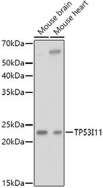 TP53I11 Antibody in Western Blot (WB)