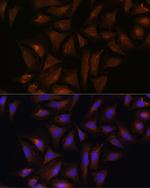 CRYZ Polyclonal Antibody