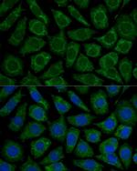 NDUFS2 Polyclonal Antibody