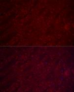 VGLUT1 Polyclonal Antibody