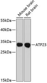 XRCC6BP1 Polyclonal Antibody