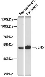 CLN5 Antibody in Western Blot (WB)