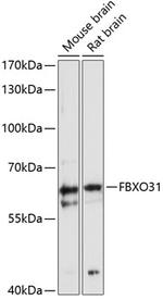 FBXO31 Polyclonal Antibody