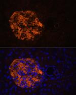 PNLIPRP2 Polyclonal Antibody