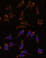 SCGN Polyclonal Antibody