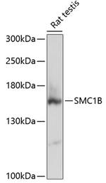 SMC1B Polyclonal Antibody