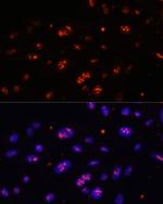 DKC1 Antibody in Immunocytochemistry (ICC/IF)
