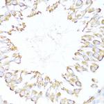 DNAJB11 Antibody in Immunohistochemistry (Paraffin) (IHC (P))