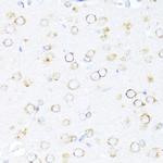 DNAJB11 Antibody in Immunohistochemistry (Paraffin) (IHC (P))