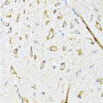 DNAJB11 Polyclonal Antibody