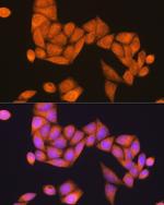 RAP1B Polyclonal Antibody