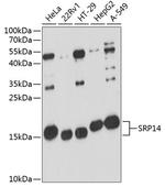 SRP14 Polyclonal Antibody