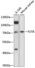 FUT8 Polyclonal Antibody