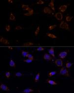 MTCH2 Polyclonal Antibody