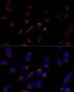 MTCH2 Antibody in Immunocytochemistry (ICC/IF)