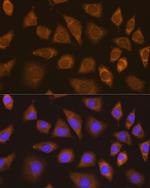 TRIM25 Polyclonal Antibody